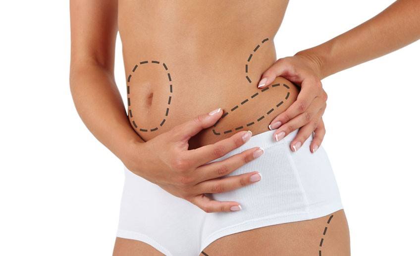 Mesoterapia Milano