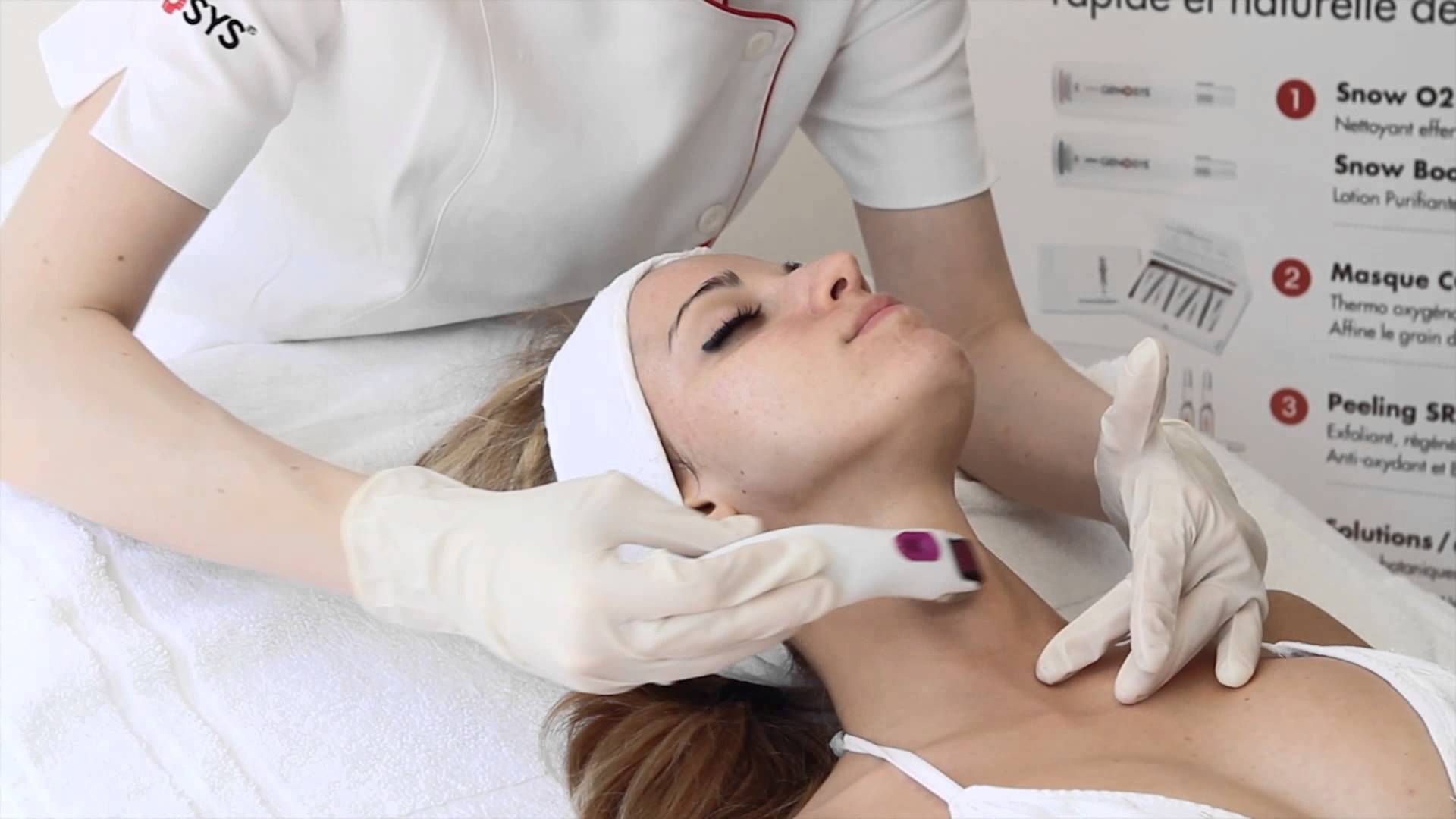 Micro needling - centro medico Milano