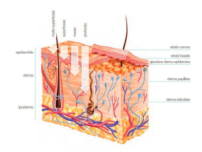 Classificazione peeling chimici